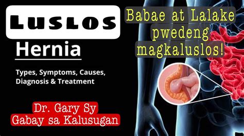 LUSLOS sa BABAE .